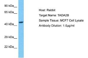 Host: Rabbit Target Name: TADA2B Sample Type: MCF7 Whole Cell lysates Antibody Dilution: 1. (TADA2B Antikörper  (C-Term))