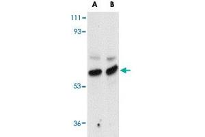 Western blot analysis of MATN3 in rat thymus tissue lysate with MATN3 polyclonal antibody  at (A) 1 and (B) 2 ug/mL . (Matrilin 3 Antikörper  (Internal Region))