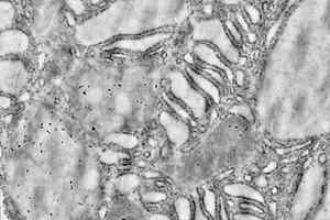 Immunoelectron Microscopy (IEM) image for anti-Heat Shock 60kDa Protein 1 (Chaperonin) (HSPD1) antibody (ABIN7074167)
