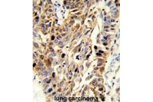 Immunohistochemistry (IHC) image for anti-Fibulin 3 (FBLN3) antibody (ABIN3004030) (FBLN3 Antikörper)