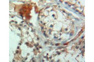 IHC-P analysis of testis tissue, with DAB staining. (CRAT Antikörper  (AA 363-626))
