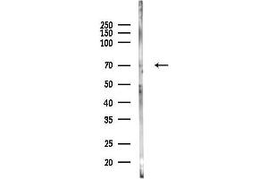 anti-Acyl-CoA Synthetase Long-Chain Family Member 3 (Acsl3) (Internal Region) antibody