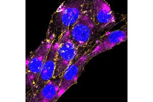 Expression of GFAP in rat C6 glioma cellsFixed and permeabilized cells were stained with Anti-GFAP-ATTO Fluor-647N Antibody (ABIN7582030), (1:200) and with CellMask Orange Actin tracking dye (yellow).