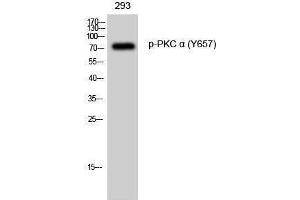 Western Blotting (WB) image for anti-Protein Kinase C, alpha (PKCa) (pTyr657) antibody (ABIN3182236) (PKC alpha Antikörper  (pTyr657))