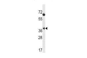 MBNL2 Antibody (C-term) (ABIN656947 and ABIN2846136) western blot analysis in Hela cell line lysates (35 μg/lane). (MBNL2 Antikörper  (C-Term))