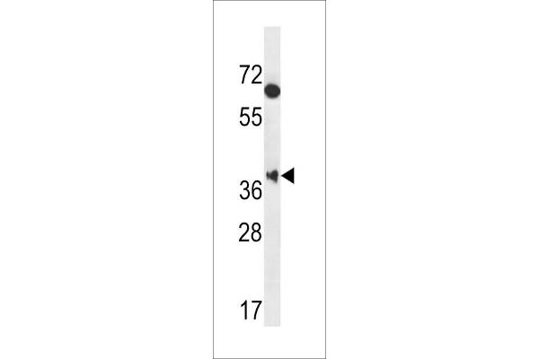 MBNL2 Antikörper  (C-Term)