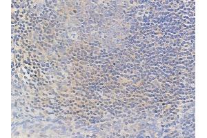ABIN6258276 and ABIN6274540 at 1/100 staining human normal tonsil tissue by IHC-P. (MLX Antikörper  (Internal Region))