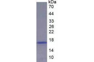 SDS-PAGE analysis of Rat Renin Protein. (Renin Protein (REN))