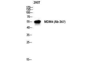 Western Blotting (WB) image for anti-Mdm4-binding Protein (MDM4) (Ser885) antibody (ABIN3185504) (MDM4-binding Protein Antikörper  (Ser885))