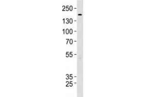 Western Blotting (WB) image for anti-Tuberous Sclerosis 2 (TSC2) (AA 1397-1426) antibody (ABIN3029313)