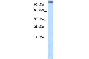 Western Blot showing MKL1 antibody used at a concentration of 1-2 ug/ml to detect its target protein. (MKL1 Antikörper  (C-Term))