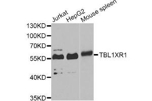 Western blot analysis of extracts of various cell lines, using TBL1XR1 Antibody (ABIN5975754) at 1/1000 dilution. (TBL1XR1 Antikörper)