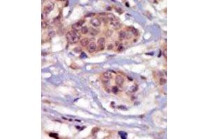 Image no. 1 for anti-FYN Oncogene Related To SRC, FGR, YES (FYN) (N-Term) antibody (ABIN359983) (FYN Antikörper  (N-Term))