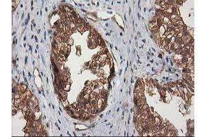 Image no. 7 for anti-Destrin (Actin Depolymerizing Factor) (DSTN) antibody (ABIN1497910) (Destrin Antikörper)