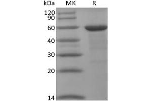 BRD4 Protein