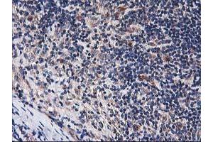 Image no. 4 for anti-Histidyl-tRNA Synthetase 2, Mitochondrial (Putative) (HARS2) antibody (ABIN1498585) (HARS2 Antikörper)