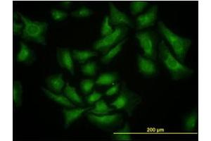 Immunofluorescence (IF) image for anti-SMAD Specific E3 Ubiquitin Protein Ligase 1 (SMURF1) antibody (ABIN781919) (SMURF1 Antikörper)