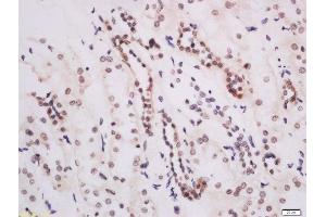 Formalin-fixed and paraffin embedded human kidney labeled with Anti-DOT1L Polyclonal Antibody, Unconjugated  at 1:200 followed by conjugation to the secondary antibody and DAB staining. (DOT1L Antikörper  (AA 51-150))