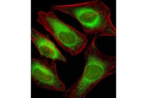 Fluorescent image of Hela cells stained with USP51 Antibody (Center) C. (USP51 Antikörper  (AA 278-307))