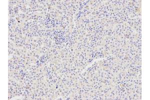 Immunohistochemistry (IHC) image for anti-TNF Receptor Superfamily, Member 6 (FAS) (AA 150-250) antibody (ABIN3020739)