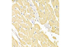 Immunohistochemistry of paraffin-embedded rat heart using RRM2 antibody at dilution of 1:100 (x400 lens).
