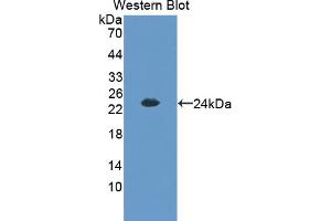 Western blot analysis of the recombinant protein. (CITED1 Antikörper  (C-Term))