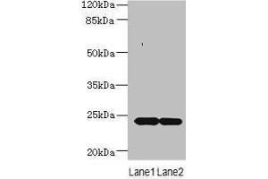 Western blot All lanes: MRAP2 antibody at 7 μg/mL Lane 1: Mouse brain tissue Lane 2: Mouse kidney tissue Secondary Goat polyclonal to rabbit IgG at 1/10000 dilution Predicted band size: 24 kDa Observed band size: 24 kDa (MRAP2 Antikörper  (AA 66-205))