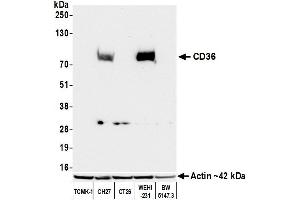 Western Blotting (WB) image for anti-CD36 (CD36) (AA 275-325) antibody (ABIN7795653)