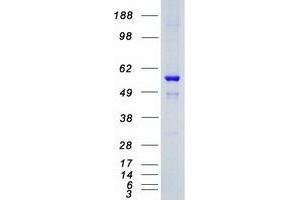 Western Blotting (WB) image for serum/glucocorticoid Regulated Kinase Family, Member 3 (SGK3) (Transcript Variant 1) protein (Myc-DYKDDDDK Tag) (ABIN2731934)