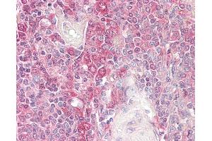 Anti-BID antibody IHC of human spleen. (BID Antikörper)