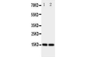 Western Blotting (WB) image for anti-Fatty Acid Binding Protein 5 (Psoriasis-Associated) (FABP5) (AA 10-23), (N-Term) antibody (ABIN3044084)