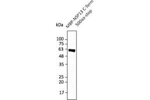 Western Blotting (WB) image for anti-SARS-CoV-2 Helicase (NSP13) (HEL) (C-Term) antibody (ABIN7273005) (SARS-CoV-2 NSP13 Antikörper  (C-Term))