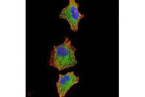 Immunofluorescence (IF) image for anti-Interleukin-1 Receptor-Associated Kinase 3 (IRAK3) (AA 454-596) antibody (ABIN5542522)