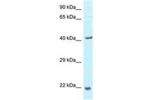 Image no. 1 for anti-Tumor Protein D52-Like 2 (TPD52L2) (AA 118-167) antibody (ABIN6747351) (TPD52L2 Antikörper  (AA 118-167))