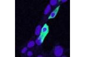 ABIN190810 (5ug/ml) staining of min6 cells transiently expressing mouse Clic4. (CLIC4 Antikörper  (N-Term))