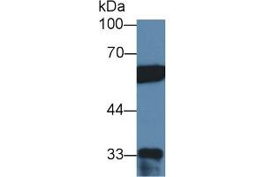 Western blot analysis of Human HeLa cell lysate, using Human PTBP1 Antibody (2 µg/ml) and HRP-conjugated Goat Anti-Rabbit antibody ( (PTBP1 Antikörper  (AA 1-531))
