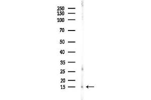 Western blot analysis of lysates from EC304 cells(heat-shock,45 min treatment), using Histone H3 Antibody at 1/1000 dilution.