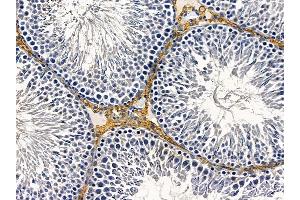 ABIN6258237 and ABIN6274591 at 1/100 staining rat testis tissue by IHC-P. (AVEN Antikörper  (C-Term))