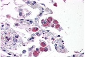 Human Lung: Formalin-Fixed, Paraffin-Embedded (FFPE) (FAM59B Antikörper  (C-Term))