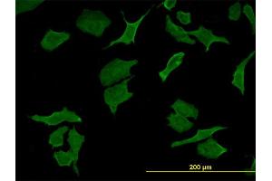 Immunofluorescence (IF) image for anti-Dihydropyrimidine Dehydrogenase (DPYD) (AA 1-110) antibody (ABIN560640)
