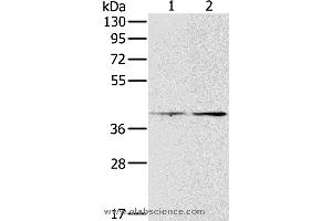 Western blot analysis of Hela and lovo cell, using PDGFRL Polyclonal Antibody at dilution of 1:400 (PDGFRL Antikörper)