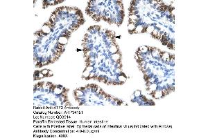 Human Intestine (ATF2 Antikörper  (C-Term))