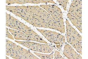 ABIN7096733 and ABIN7100798 at 1/100 staining rat muscle tissue by IHC-P. (TRABD Antikörper)
