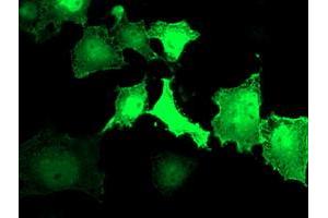 Anti-LDLRAP1 mouse monoclonal antibody (ABIN2455230) immunofluorescent staining of COS7 cells transiently transfected by pCMV6-ENTRY LDLRAP1 (RC206643). (LDLRAP1 Antikörper)