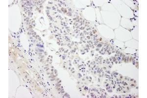 anti-DEAD (Asp-Glu-Ala-Asp) Box Polypeptide 54 (DDX54) (AA 625-675) antibody