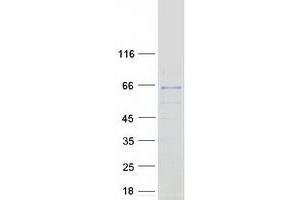 Western Blotting (WB) image for MON1 Homolog B (MON1B) protein (Myc-DYKDDDDK Tag) (ABIN2726225)