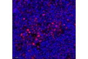 Immunofluorescence of paraffin embedded mouse spleen using ZC3H11A (ABIN7076255) at dilution of 1: 650 (550x lens) (ZC3H11A Antikörper)