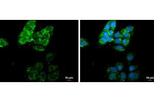 ICC/IF Image MMP13 antibody [N3C1], Internal detects MMP13 protein at cytoplasm by immunofluorescent analysis. (MMP13 Antikörper)