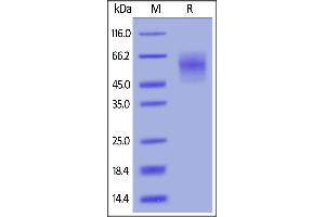Biotinylated Human CEACAM-6, His,Avitag on  under reducing (R) condition. (CEACAM6 Protein (AA 35-320) (His tag,AVI tag,Biotin))