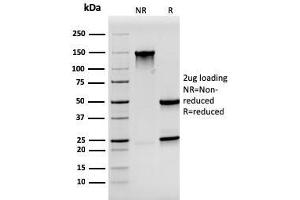 SDS-PAGE Analysis Purified Synaptophysin Mouse Monoclonal Antibody (SYP/3551). (MSH2 Antikörper  (AA 224-313))